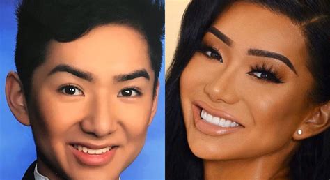 nikita dragun before surgery|The truth about Nikita Dragun